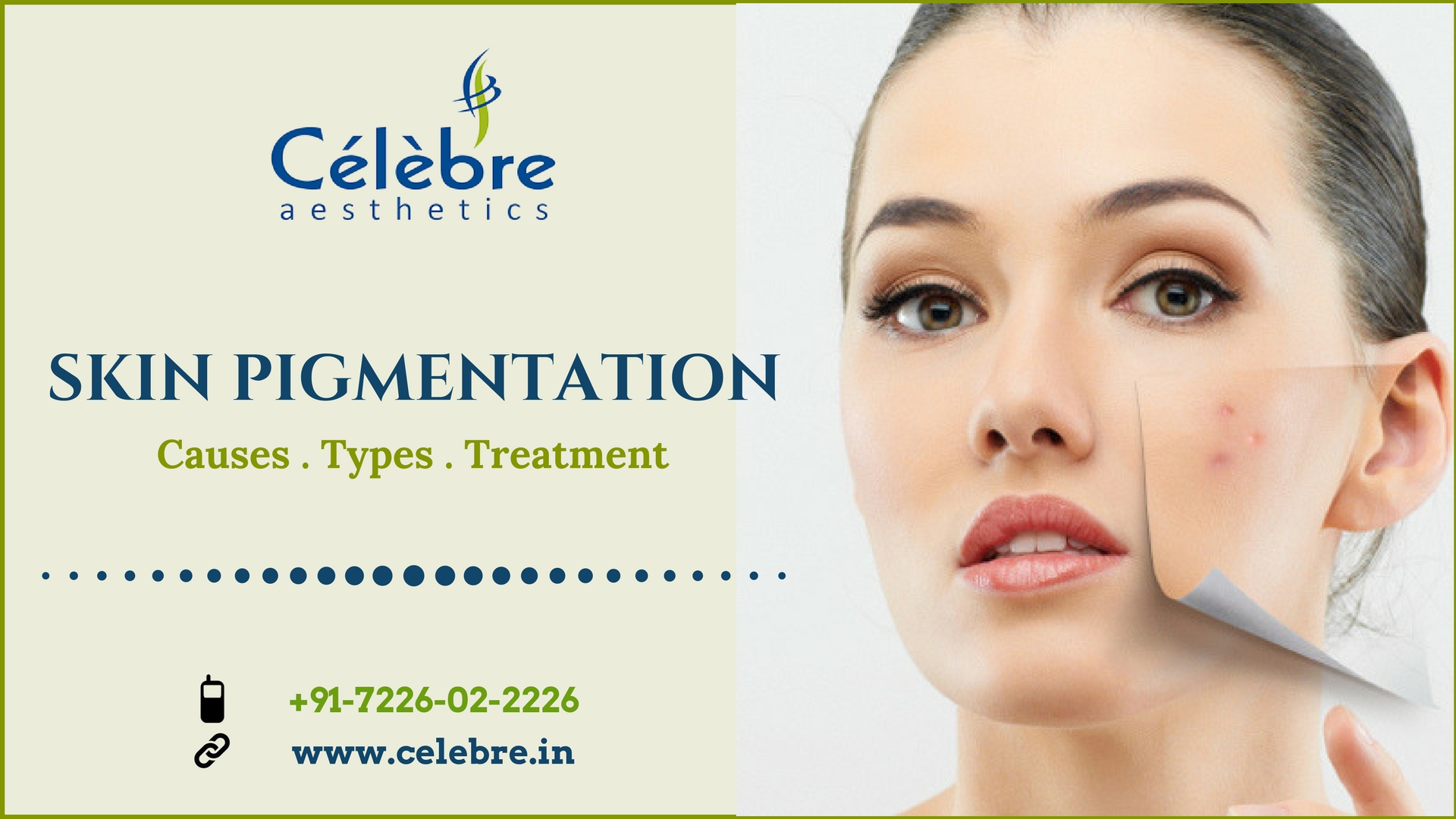 Skin Pigmentation Causes, Types and Treatment in Surat