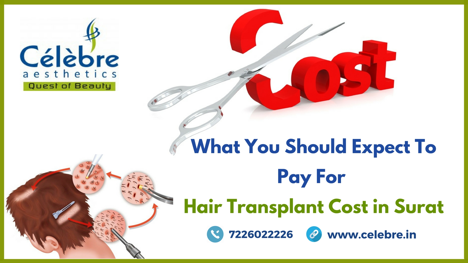 Details 54+ hair transplant in surat - in.eteachers